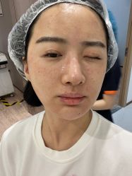 体验后-深圳美莱医疗美容医院