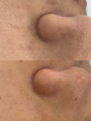 -蕾特恩专业祛痘·皮肤管理