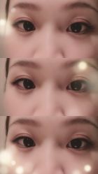 -元熙兰积皮肤管理