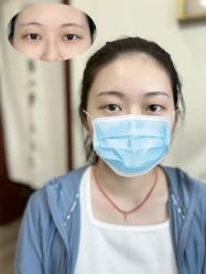 点击看大图 -张小野·专业半永久纹眉