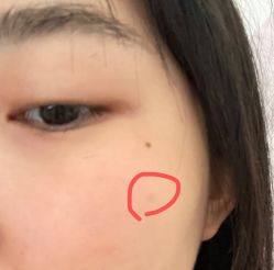 -成都西区医院整形美容