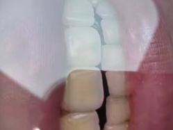 -瑞丽口腔·美学矫正中心