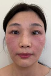 点击看大图 -海涛医疗美容·面部抗衰·注射美鼻