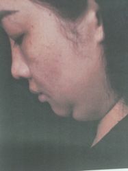 -广州美莱医疗美容医院