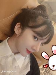 点击看大图 -大麦微针植发丨全国连锁