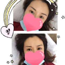 -西施无菌半永久纹绣眉眼影唇轻增发纹发际线