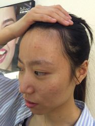 水光针-光SPA科技美肤