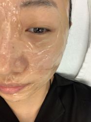 体验前-叶美人医疗美容