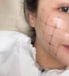-广州美莱医疗美容医院