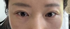 体验后-广州美莱医疗美容医院