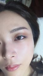 体验后-北京英煌医疗美容