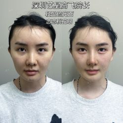 -深圳艺星医疗美容医院