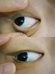-肌理言健康美肌驻颜所
