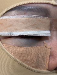 体验后-上海玫瑰医疗美容医院