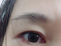 -南昌大学附属眼科医院(东湖院区)