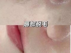 -尔悦采耳·头疗·SPA体验馆(万象城店)