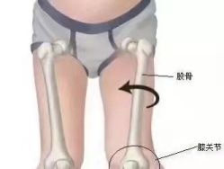 点击看大图 -易型AT20科技健康