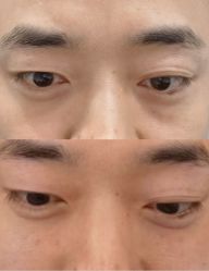 -郡艺医疗美容·微整·眼鼻吸脂