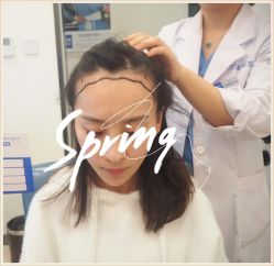 -大麦微针植发全国连锁