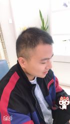 -大麦微针植发丨全国连锁