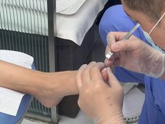 -Andrew指甲专科灰指甲·甲沟炎矫正·3D步态矫形鞋垫定制(浦三路店)