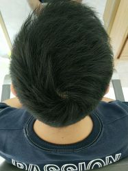 -发饰美男士增发补发假发定制店