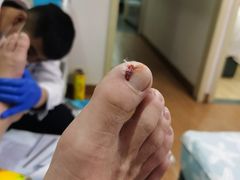 -杨一刀修脚(马连道南街店)