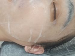 -长沙雅美医疗美容医院