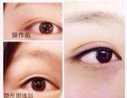 iphone_upload_pic-百秀名媛纹绣美学护肤中心