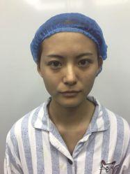 -深圳悦她医疗美容