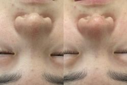 -SKIN79皮肤管理中心