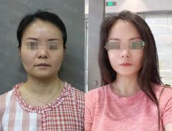 -加减美医美连锁品牌