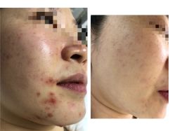 -康美贞·痘肌养护管理中心