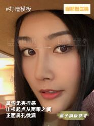 -北京米扬丽格医疗美容·联合丽格鼻整形中心