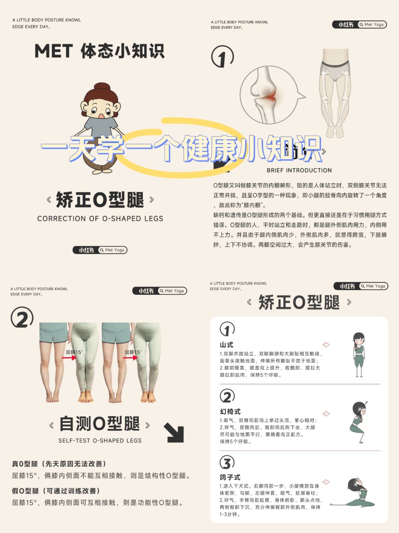 自测是o型腿的旁友们,要好好注意了,站立走路时,大腿内侧肌肉用不上力