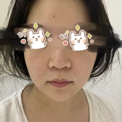 体验后-北京炫美医疗美容