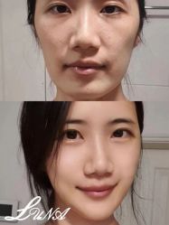 -LUNA皮相美·骨相美高级美感