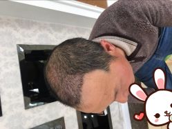 -大麦微针植发丨全国连锁