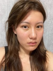-杭州奥拉克医疗美容门诊部