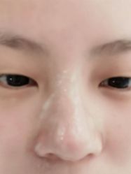 -痘院长·祛痘·皮肤管理