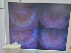 -爱牙联合口腔(门诊报销 海云庵店)