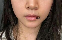 -天津健丽·去眼袋医疗美容机构