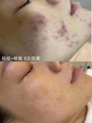 -佳慕·痘痘·问题肌管理中心