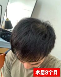 -雍禾植发全国连锁