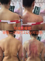 -丽减美瘦吧·减肥瘦身