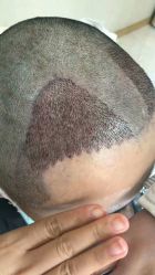 -雍禾植发全国连锁