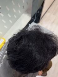 -雍禾植发