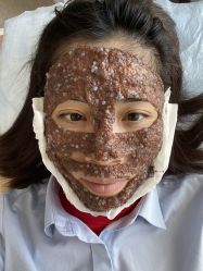 -清颜堂丨分子祛痘·功效美肤
