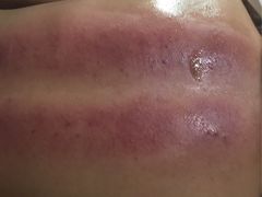 -益友堂盲人推拿正骨穴位按摩工作室