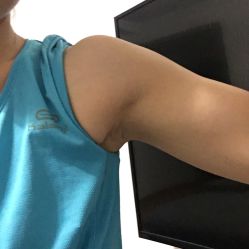 -洁铭新加坡医美